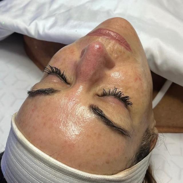 (3) HydroDiamond Facials